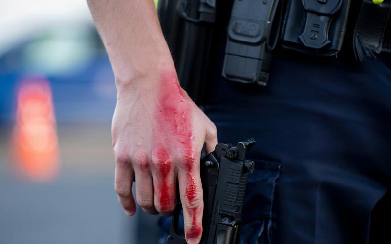 Policial ferido por defeito da própria arma — STJ decide se cabe ou não direito à indenização